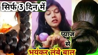 सिर्फ तीन दिन में भयंकर लंबे बाल एक टूटेंगे 10 बाल 100 निकलेंगे haircare hairfall hairgrowth [upl. by Nehcterg]