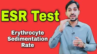 ESR Test  Erythrocyte Sedimentation Rate  High ESR Causes [upl. by Emiolhs]