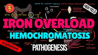 HEMOCHROMATOSIS Pathogenesis Mechanism of clinical symptoms Diagnostic criteria Treatment [upl. by Ailiec194]