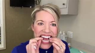 SMILE SCIENCES Tooth Whitening Kit Demo amp First Impressions [upl. by Acyssej]