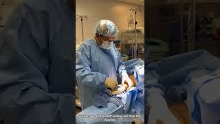 VASER Liposuction for Lipedema  Is It Helpful  Dr Boris Volshteyn [upl. by Alfonse248]