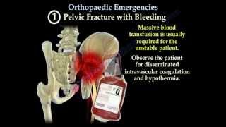 Orthopaedic Emergencies Part 1  Everything You Need To Know  Dr Nabil Ebraheim [upl. by Yelsehc]