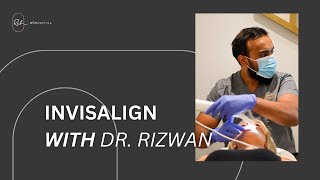 Benefits of Invisalign With Dr Rizwan [upl. by Chernow]