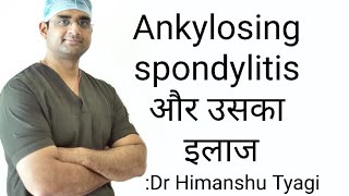 Ankylosing spondylitis और उसका इलाजTreatment [upl. by Amalberga]