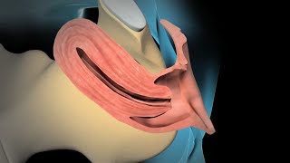 Dilation and Curettage D amp C [upl. by Bevon]