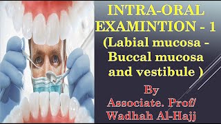 10Intraoral examination1 Labial buccal mucosa and vestibule–oral diagnosis lecturesدوضاح الحاج [upl. by Lalise111]