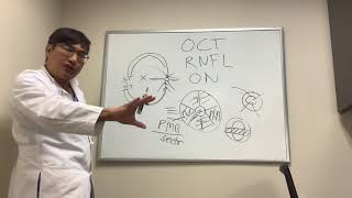 Understanding Optic Nerve OCT [upl. by Lukasz]