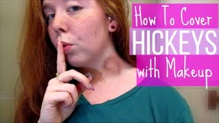 How To Cover Hickeys with Makeup  Lets Talk [upl. by Nyleuqcaj]