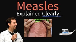 Measles rubeola Explained Clearly by MedCramcom [upl. by Greyson]