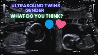 Ultrasound Pregnancy Twins Gender Identification Special interaction between the twins ❤️ [upl. by Llerrem]