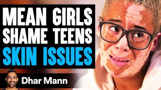 MEAN GIRLS Shame TEENS SKIN ISSUES What Happens Next Is Shocking  Dhar Mann [upl. by Cirek]