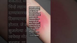 नेक्रोबायोसिस लिपोइडिका कंडिशन Necrobiosis Lipoidica health diabetes disease healthytips short [upl. by Iral]