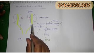 Mullerian Duct Anomalies [upl. by Barton]