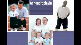 Autosomal and Chromosomal Disorders [upl. by Lambart]