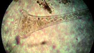 Protist under the microscope [upl. by Pepillo]