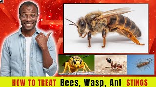 How to Care for Bee sting Wasp ant amp Centipede stings [upl. by Haikezeh622]