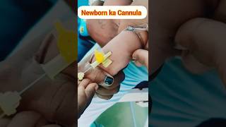 Cannula insertion for newborn trending shorts viral [upl. by Salzhauer]