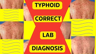 TYPHOID CORRECT LAB DIAGNOSIS [upl. by Kevin]