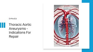 Thoracic Aortic Aneurysm  Indications For Repair [upl. by Ahsikat]