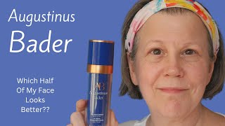 Using Augustinus Bader On Half My Face For 12 Months  Did It Help [upl. by Neff]