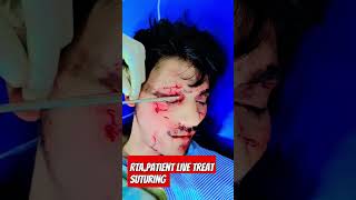 LIVE suturing  RTA WITH HEAD Injury shorts [upl. by Jaye572]