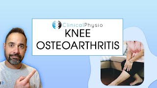 What is Knee Osteoarthritis OA  Expert Physio Guides you through Anatomy Diagnosis and Treatment [upl. by Francyne]