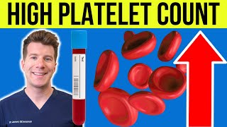 Doctor explains HIGH PLATELET COUNT Thrombocytosis  Causes symptoms and more [upl. by Helse]