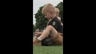 Nonprofit raises money for kids who need prosthetic legs [upl. by Cormac624]