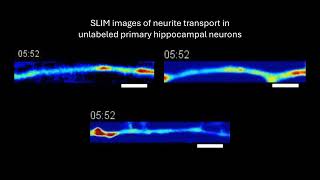 VideoOfTheDay Timelapse imaging and measurement of mass transport in neurites [upl. by Leal351]