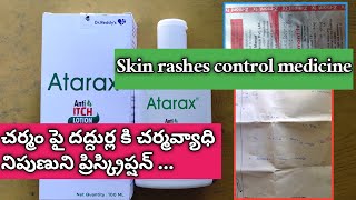 skin rashes control with Atarax lotion amp Z mont fx tablet amp xyzal l dermatologist prescription [upl. by Inanaup]