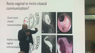 Radiological interpretation of cloacal MRI images by professor Alberto penia [upl. by Seve]