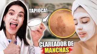 Use TAPIOCA para Clarear as Manchas de Pele [upl. by Steep]