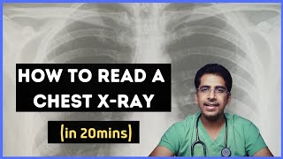 How to read a chest Xray in 20 mins [upl. by Osterhus]