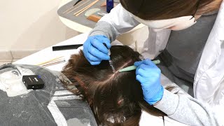 ASMR Detailed SCALP Check Up with TREATMENT  Massage Hair Combing Real Person [upl. by Hashum]