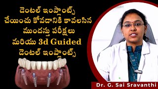 PreRequisites for Dental Implants and Advanced Guided implants  Dr GSai Sravanthi [upl. by Howlend289]