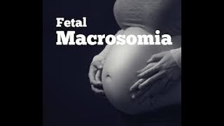 Fetal Macrosomia [upl. by Tj]