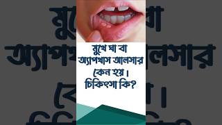 জেনে নিন মুখে ঘা বা অ্যাপথাস আলসার কেন হয় করনীয় কি মুখেঘাহলেকরনীয় mouthulcer apthousUlcer [upl. by Jahdol518]