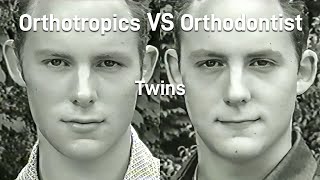 Why You Shouldnt Extract Teeth Orthotropics VS Orthodontist  Dispatches 1999 [upl. by Moyers]