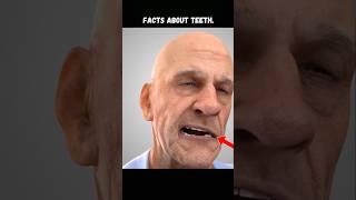 Are Your Teeth Crooked Discover The Solution with Braces  shorts shortfacts viralfactsbraces [upl. by Tait]