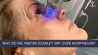 Powerful Skin Tightening with Radio Frequency Microneedling [upl. by Drogin]