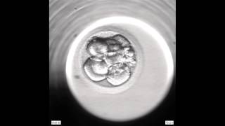 Development of an Embryo from 2PN to Blastocyst via an EmbryoScope [upl. by Thissa]