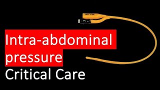 HOW and WHY do we measure intra abdominal pressure [upl. by Enna785]