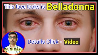 Belladonna homeopathic medicine symptom  Belladonna  Dr S Basu [upl. by Spears756]