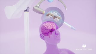 How TMS Works A StepbyStep Explanation of How Transcranial Magnetic Stimulation Treats Depression [upl. by Aisatan]