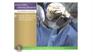 Pediatric ColostomyIleostomy Your Childs ColostomyIleostomy [upl. by Parish929]