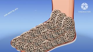 asmr trypophobia infected leg treatment  ASMR animation treatment video [upl. by Pompei]