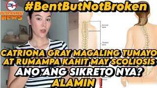 CATRIONA GRAY NADIAGNOSE NA MAY SCOLIOSIS NOONG 12 YEARS PA LANG SIYA [upl. by Egief884]