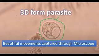 Motile trophozoite of Trichomonas under the Microscope [upl. by Eadrahs]