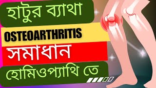 OSTEOARTHRITIS  KNEE JOINT PAIN  সম্পূর্ণ HOMEOPATHIC সমাধান [upl. by Maurreen]