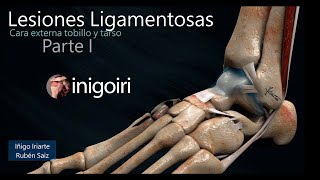 US EN LESIONES LIGAMENTOS EXTERNOS DEL TOBILLO PARTE I [upl. by Haswell608]